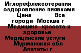 Иглорефлексотерапия, оздоровление пиявками › Цена ­ 3 000 - Все города, Москва г. Медицина, красота и здоровье » Медицинские услуги   . Мурманская обл.,Апатиты г.